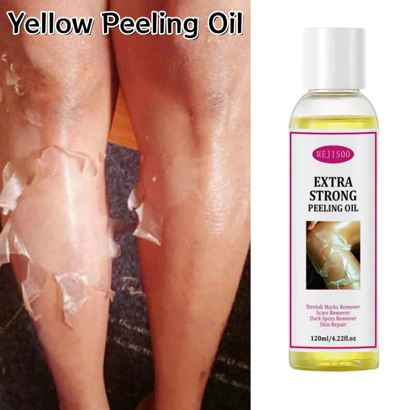 Exfoliating Yellow Peeling Oil Gentle Clean Remove Dead Skin Body Peeling Serum Moisturizing Smooth Tender Skin